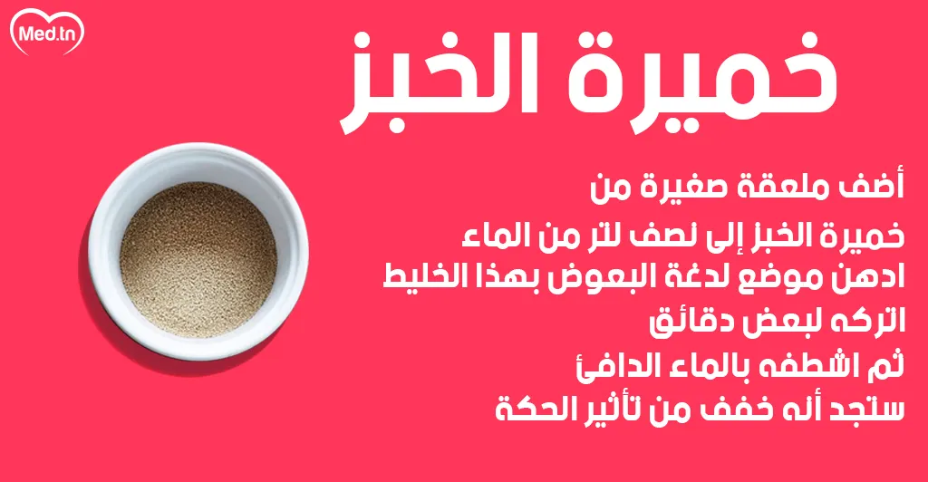 6 طرق طبيعية لعلاج قرصة الناموس